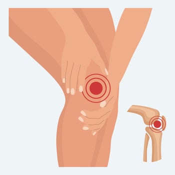 Pain in the knee joint, knee arthritis, leg pain due to rheumatoid arthritis. Anatomy of human bones. Illustration, vector