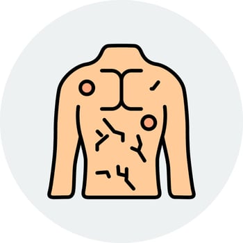 Hives Vector Icon