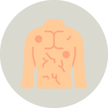 Hives Vector Icon