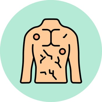 Hives Vector Icon