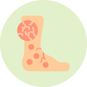 Hives Vector Icon