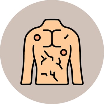 Hives Vector Icon
