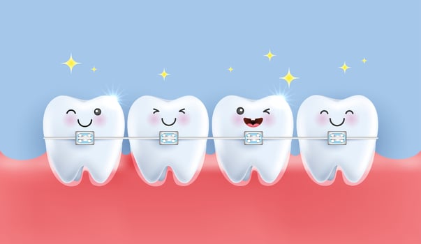 Orthodontic dentistry. alignment of the bite of teeth, dentition with braces, dental braces. healthy lifestyle and dental care. medical apps, websites and hospital. vector. vector