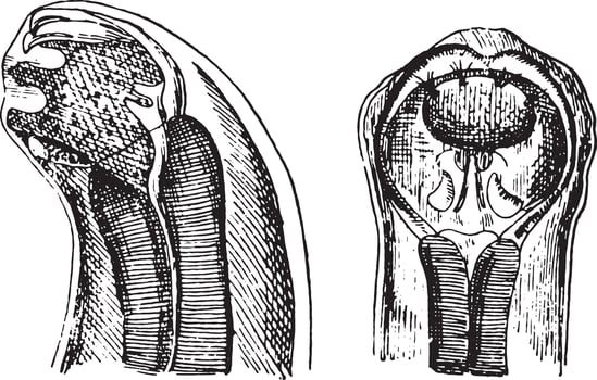 Cephalic extremity of dochmius duodenalis, vintage engraving. vector