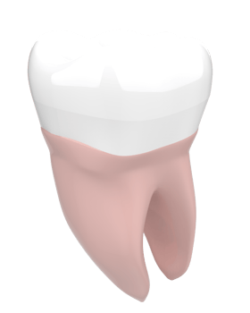 Tooth implant isolated on background. 3d rendering- illustration png