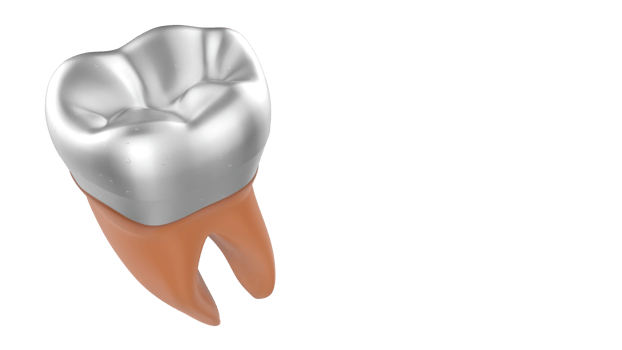 Tooth implant isolated on background. 3d rendering- illustration png
