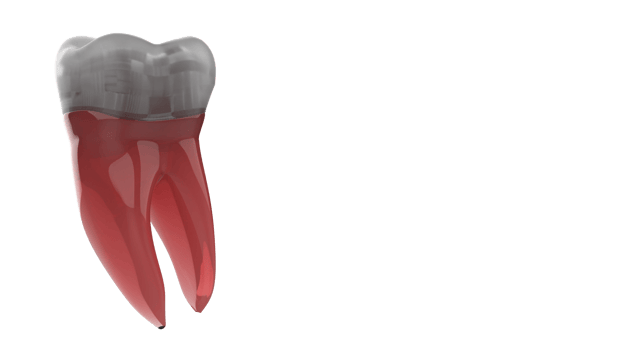 Tooth implant isolated on background. 3d rendering- illustration png