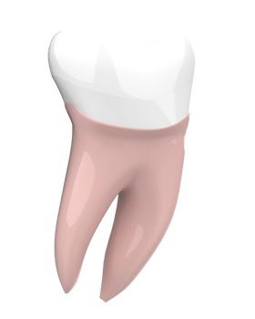 Tooth implant isolated on background. 3d rendering- illustration png