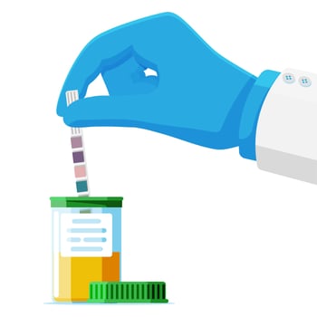 Hand of Doctor Holding Urine PH Test Strip in Jar Isolated. Laboratory Urine Test Sample. Diagnosis Urinary Tract Infection. Urological Analysis and Examination. Flat Vector Illustration