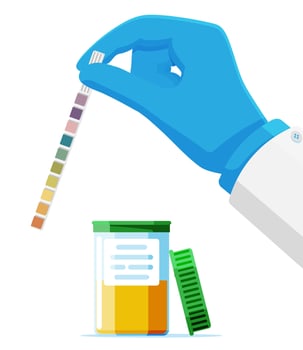 Hand of Doctor Holding Urine PH Test Strip in Jar Isolated. Laboratory Urine Test Sample. Diagnosis Urinary Tract Infection. Urological Analysis and Examination. Flat Vector Illustration