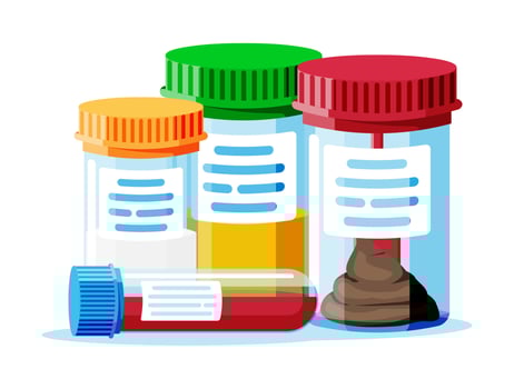 Test Tubes with Caps. Stool, Blood, Urine and Sperm. Medical Equipment. Specimen Cups for Gynecological Analysis. Plastic Containers with Biomaterial Analysis in Laboratory. Flat Vector Illustration