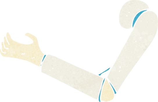 cartoon prosthetic arm png
