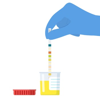 Hand in white glove holding urine strip for diagnosis urinary tract infection isolated on white background. Medical examination. Vector illustration in flat style