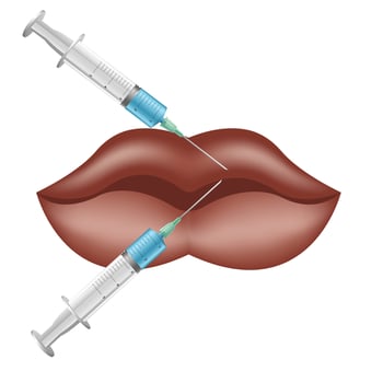 Lip augmentation and correction. Lip filler injections. Hyaluronic acid vector