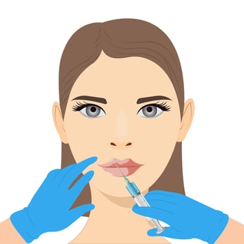Lip augmentation and correction. Lip filler injections. Hyaluronic acid. Cosmetology procedure vector