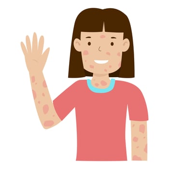 woman with leprosy disease smile and arms raised vector
