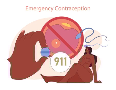 Types of Contraception. Illustration of emergency contraception as a critical vector