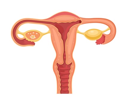Female genital organ. Uterus and tubes. Vector illustration on white background