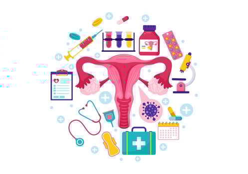 Endometriosis Vector Illustration with Condition the Endometrium Grows Outside the Uterine Wall in Women for Treatment in Flat Cartoon Background