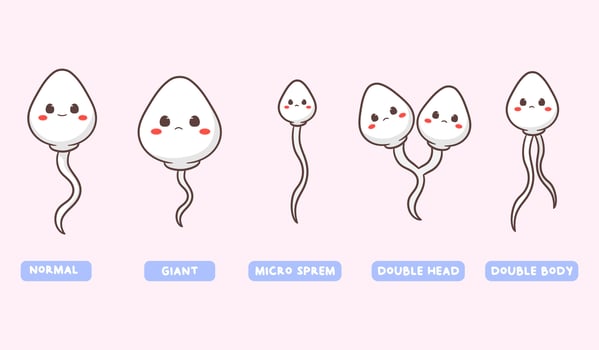 Abnormal sperm illustration. Cute sperm cartoon character. Healthy and unhealthy sperm cells. Health concept design vector