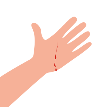 Wound on the hand palm. Red blood, infection in the cut. Skin injury. Idea of health treatment and first aid. Isolated illustration in cartoon style png