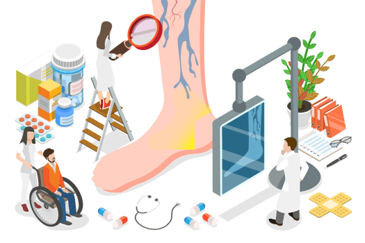 3D Isometric Flat Conceptual Illustration of Varicose Veins png
