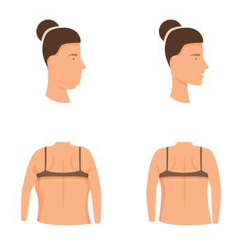 Plastic surgery icons set cartoon . Facial and body lift plastic surgery vector