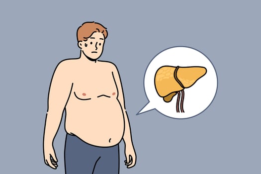 Liver illnesses in men cause obesity and digestive problems and symptoms of fatty hepatosis vector