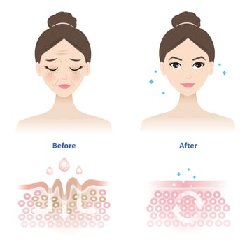 Comparison of woman face before and after wrinkle skincare absorption illustration on white background. Cross section of wrinkles skin and skincare absorbing to help reduce aging and damaged skin. vector