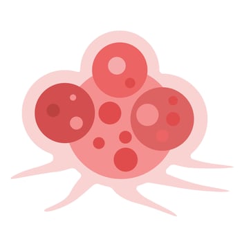 cancer cell growth. cancer disease concept vector