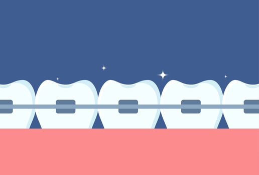 Row of teeth with braces on them. Orthodontics and aesthetic dentistry medicine. Molars with braces. Dentistry, whitening, orthodontics. . vector