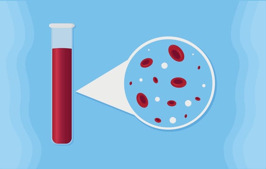 cells in a test tube. illustration of a magnifying glass with a blood. Blood test illustration. vector
