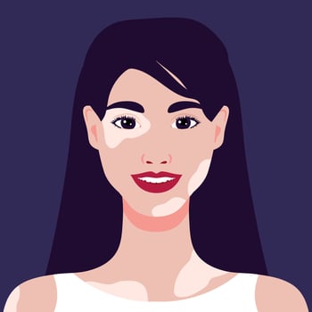 Beautiful smiling young woman with vitiligo depigmentation. Rare appearance. Portrait or an avatar. illustration vector