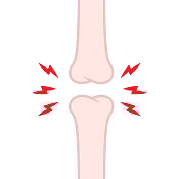 Knee bone problems. Bone cartoon . vector