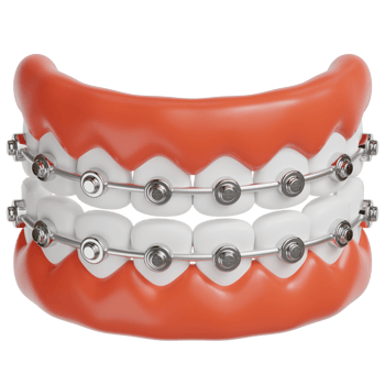 Braces 3d illustration png