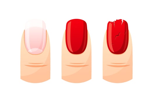 Finger nail isolated on white background. vector