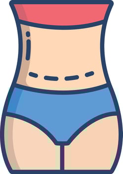 C-section delivery linear color illustration vector