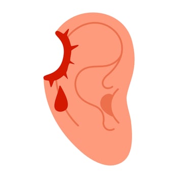 Wounded ear. bullet hole. Injured human ear with blood drops. a sense of injury or pain associated with the ear. Flat style illustration vector