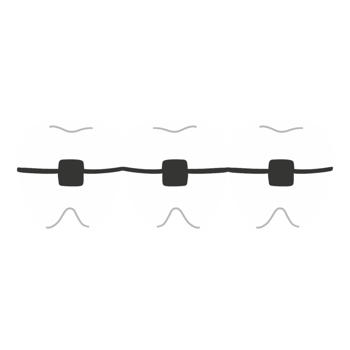 teeth with braces illustration png