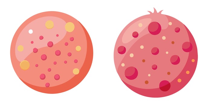 illustrations of acne. Each illustration depicts a circular face with various types of acne spots, including pimples and blemishes, in shades of pink and red vector