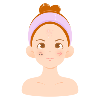 Acne Care Illustration, Skin with Acne Issues png