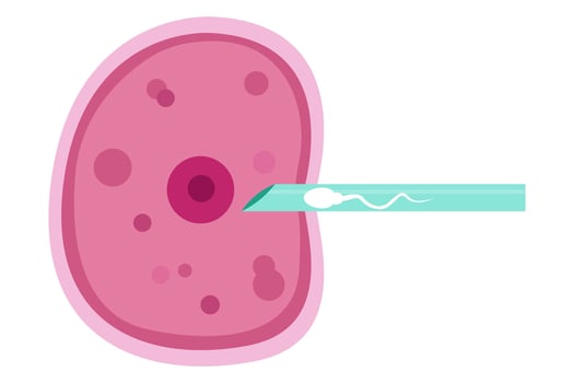 sperm and egg fertillization. In Vitro Fertillization , IVF vector