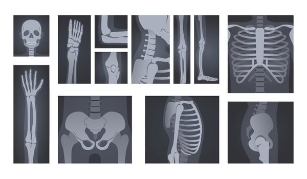 X-ray shots. Human body radiology of head skull, hand bones, spine and rib cage illustration set vector