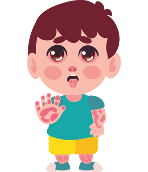 A cartoon boy with a rash on his face png