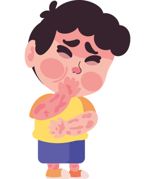 A boy with a rash on his face png