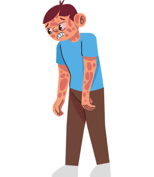 Illustration of a boy with skin rash png