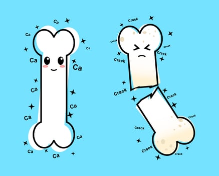 Healthy happy bone and sick sad unhealthy osteoporotic bone, fracture vector