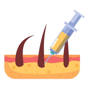 Syringe injecting serum into skin for hair growth treatment vector