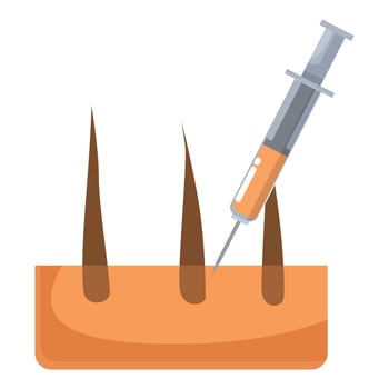 Syringe injecting substance into skin for hair growth treatment vector