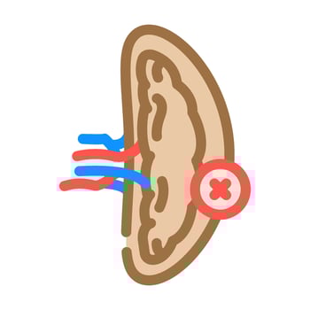 splenectomy surgery color icon illustration vector